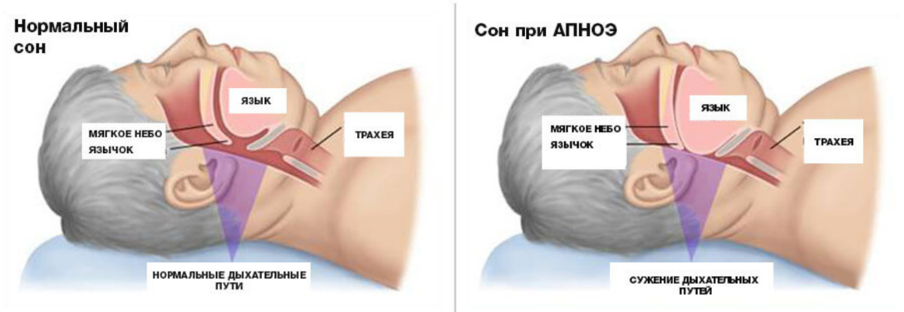 Дыхательные пути во время сна 