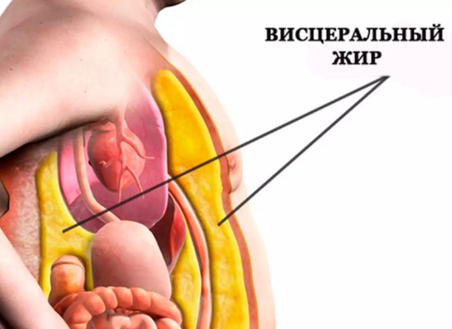 Висцеральный жир опаснее для здоровья, чем подкожный