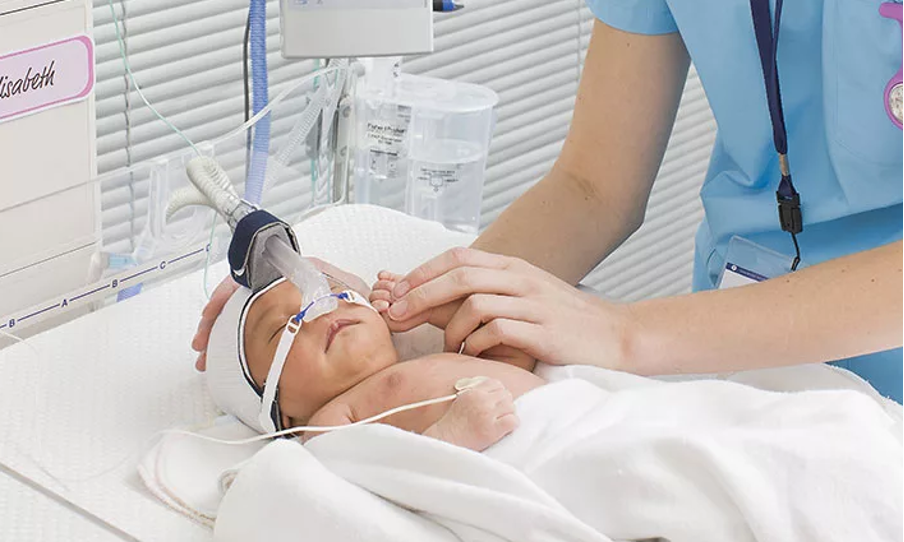 3_1.png Нарушения дыхания во сне часто бывают у недоношенных детей