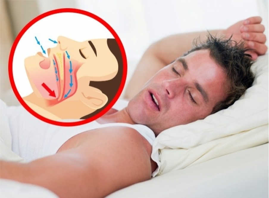 Сужение дыхательных путей наиболее вероятно во время сна на спине Сужение дыхательных путей наиболее вероятно во время сна на спине
