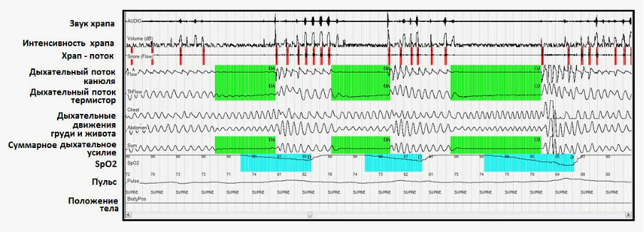 Запись кардиореспираторного мониторинга с использованием MediByte МР-8