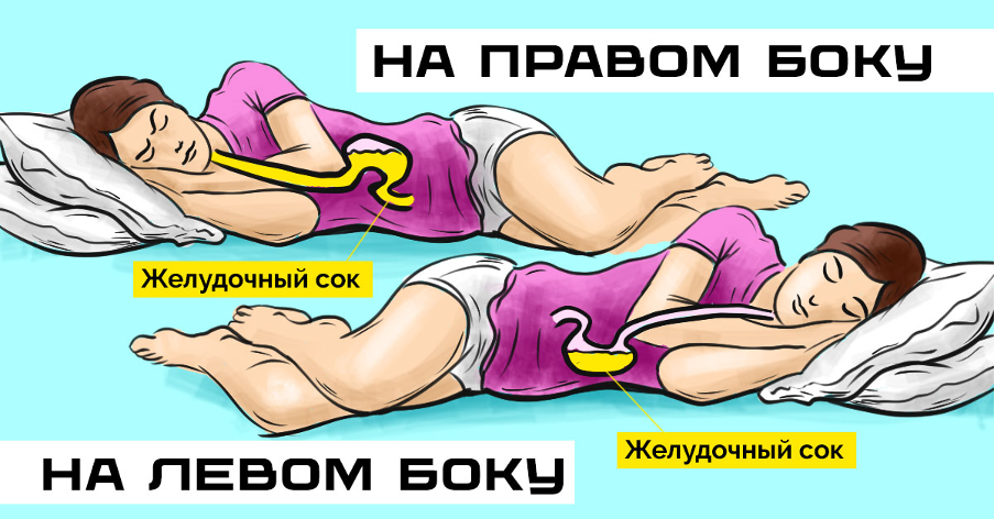 Спать на левом боку полезно для ЖКТ: снижается риск изжоги Спать на левом боку полезно для ЖКТ: снижается риск изжоги