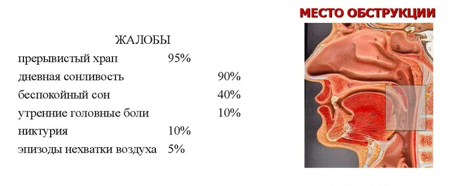 1_7.png Распространенность типичных симптомов апноэ