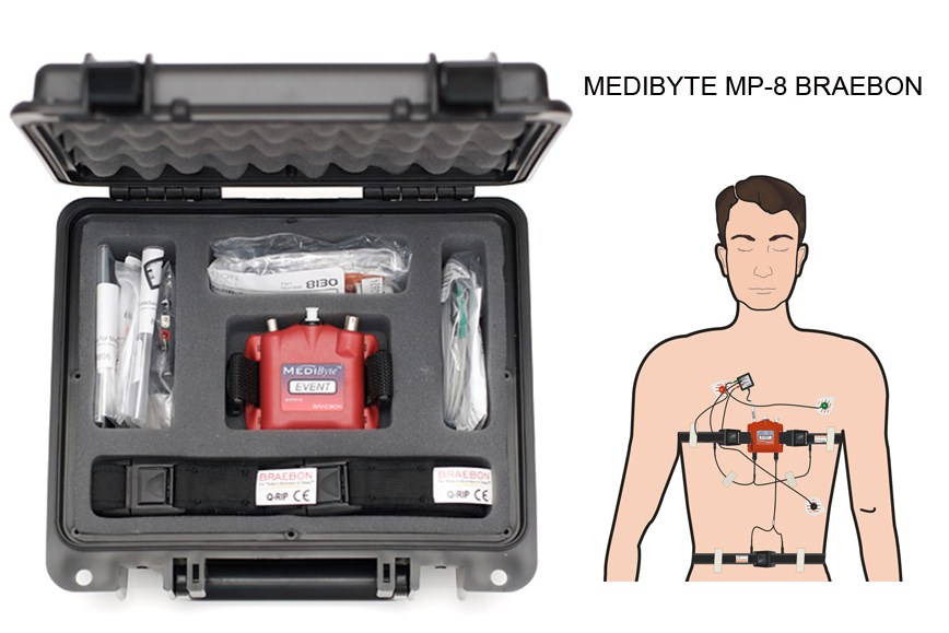 Кардиореспираторный мониторинг — доступная альтернатива полисомнографии