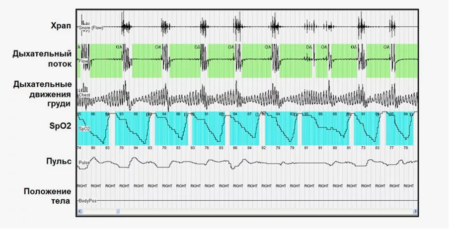 Стандартный набор кардиореспираторных параметров 