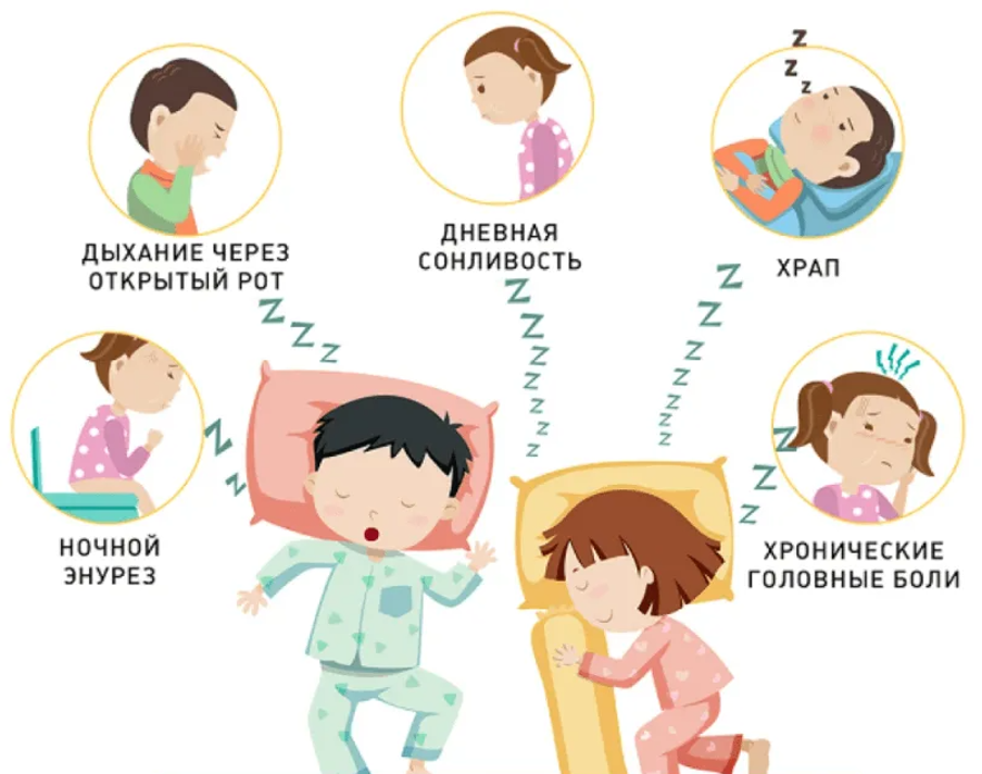 Симптомы детского апноэ Симптомы детского апноэ