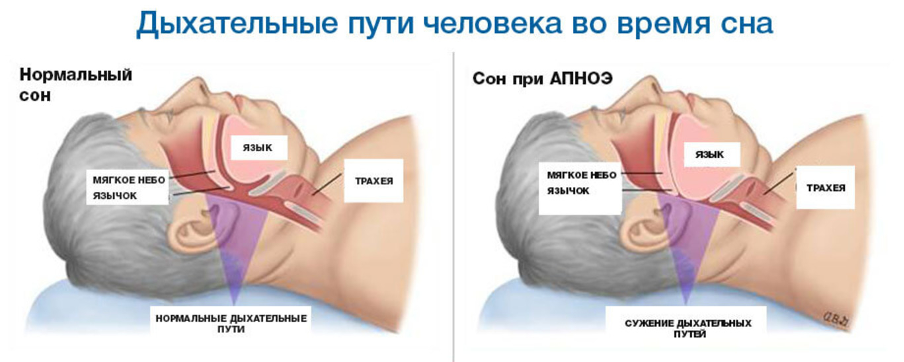 Дыхательные пути человека по время сна